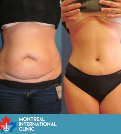 Montreal International Clinic