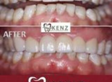 Kenz Dental & Orthodontic Care
