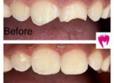 Pearly White Dental Center