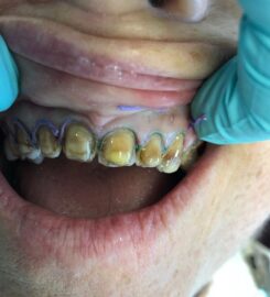 Precision Dental Clinic